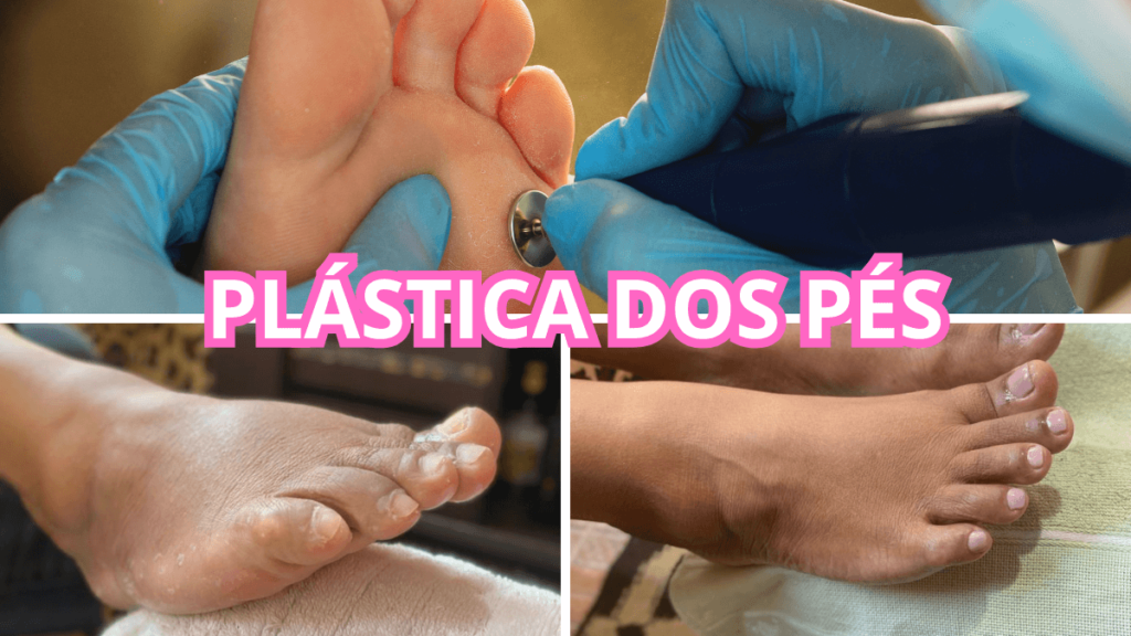 Elaine Manicure e Pedicure na Casa Verde: Transforme Suas Unhas em Obras de Arte com Atendimento Personalizado 3 PLASTICA DOS PÉS NA CASA VERDE